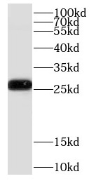 COMMD5 antibody|COMMD5抗体