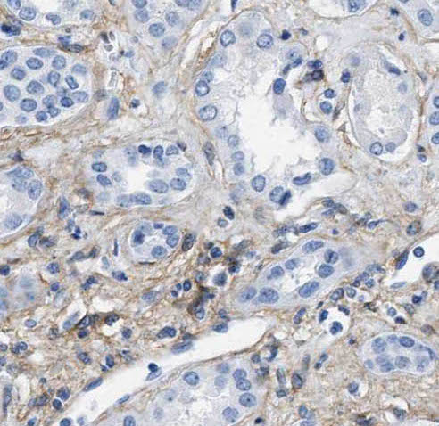 PIN1 antibody|PIN1抗体