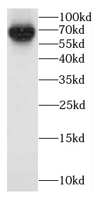 CADM4 antibody|CADM4抗体