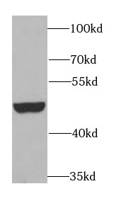 BCS1L antibody|BCS1L抗体 FNab008
