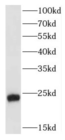 FGF8 antibody|FGF8抗体