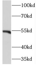 NEK11 antibody|NEK11抗体