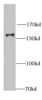 RNF40 antibody|RNF40抗体