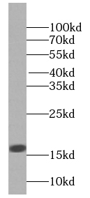 H2AC6 antibody|H2AC6抗体