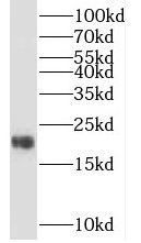 TIMM22 antibody|TIMM22抗体