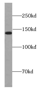 DIAPH1 antibody|DIAPH1抗体