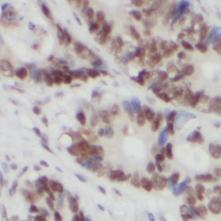 FUS antibody|FUS抗体 FNab03242