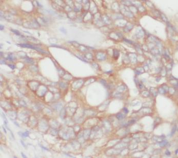 CD9 antibody|CD9抗体 FNab01508