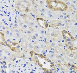 HK3 antibody|HK3抗体 FNab03894