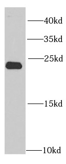 PSMB2 antibody|PSMB2抗体