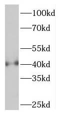 PHF6 antibody|PHF6抗体