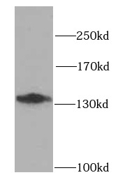 CDH2 antibody|CDH2抗体 FNab05569