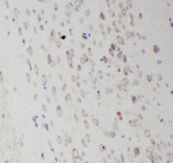 RAB35 antibody|RAB35抗体