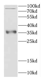 CCS antibody|CCS抗体
