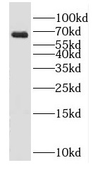 GAD2 antibody|GAD2抗体 FNab03292