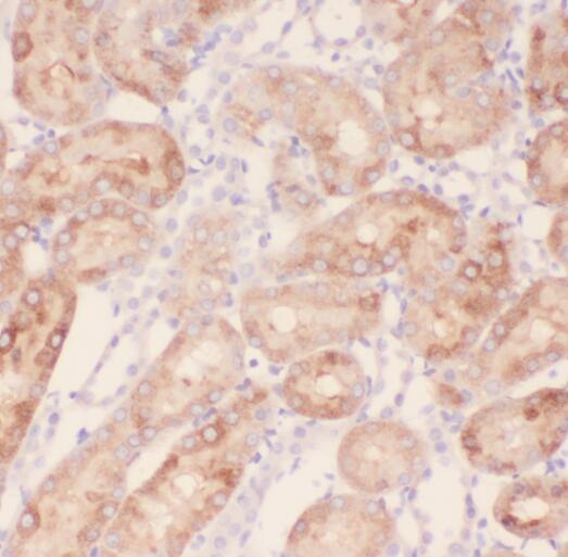 RABL2A antibody|RABL2A抗体