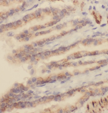 MEPE antibody|MEPE抗体 FNab05129