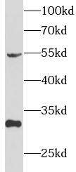 TFPI antibody|TFPI抗体