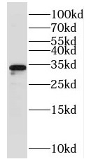 NTHL1 antibody|NTHL1抗体 FNab058