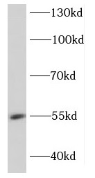 DDX49 antibody|DDX49抗体