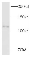 RBM10 antibody|RBM10抗体