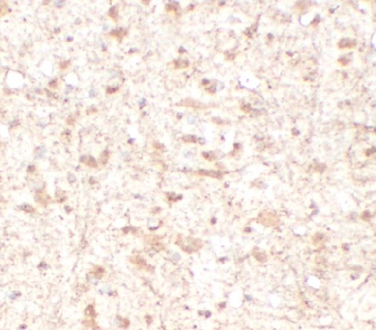 BDNF antibody|BDNF抗体 FNab10014