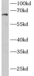 DBH antibody|DBH抗体 FNab09982