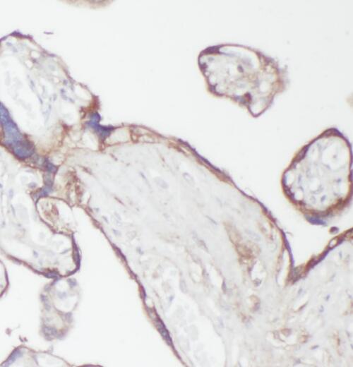 PPA2 antibody|PPA2抗体