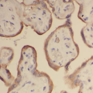 PLAAT5 antibody|PLAAT5抗体