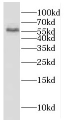 ESAM antibody|ESAM抗体