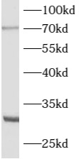 ATG16L2 antibody|ATG16L2抗体