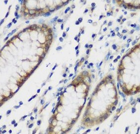 TTBK2 antibody|TTBK2抗体