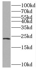 RTN2 antibody|RTN2抗体
