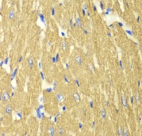 TPM3 antibody|TPM3抗体 FNab08890