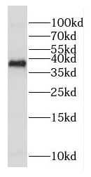 COX18 antibody|COX18抗体