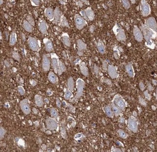 AKAP7 antibody|AKAP7抗体