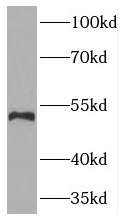 TYMP antibody|TYMP抗体