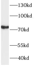 TBR1 antibody|TBR1抗体