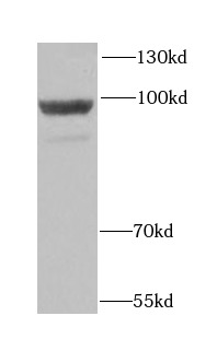 HK3 antibody|HK3抗体 FNab03894