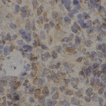 SYK antibody|SYK抗体 FNab08413