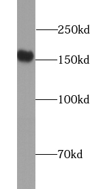 VLDLR antibody|VLDLR抗体