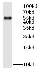 SARS2 antibody|SARS2抗体