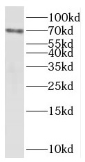 PAPSS1 antibody|PAPSS1抗体