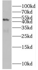 SLC25A24 antibody|SLC25A24抗体