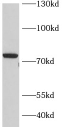 ADARB1 antibody|ADARB1抗体
