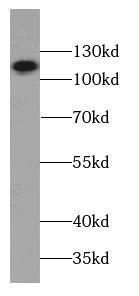 SPECC1 antibody|SPECC1抗体