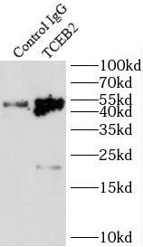 SRF antibody|SRF抗体