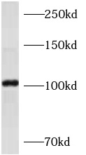 AP1B1 antibody|AP1B1抗体
