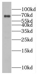 EIF3L antibody|EIF3L抗体