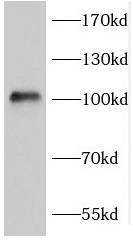 FGFR4 antibody|FGFR4抗体